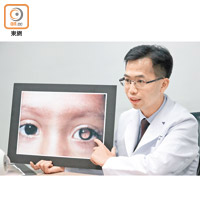 任卓昇說，患者因眼內腫瘤遮擋血管，經閃光反射出如「貓眼」般呈白色瞳孔。（黃仲民攝）
