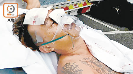尖沙咀遇襲越南漢面傷昏迷送院。（郭錦良攝）