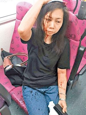 候車女乘客被擊中後腦浴血。（網民Zeus Tam圖片）