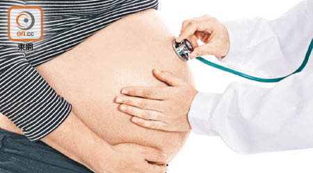 患有妊娠糖尿病的孕婦較易誕下巨嬰。（資料圖片）