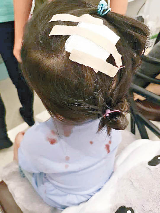 波波池鐵釘插頭三歲女頭破血流 東方日報