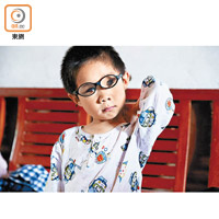 奧比斯團隊此行亦處理不少兒童眼疾個案，圖中兒童患有先天性弱視，已接受手術治療。（受訪者提供）