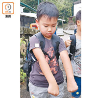 不少長洲學童都擔心被蚊叮。