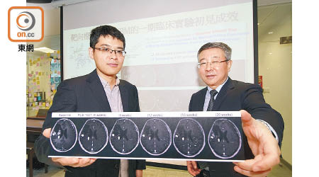 王吉光（左）與江濤合作實驗基因突變機制的臨床應用，為化療無效的腦癌患者提供新療法。