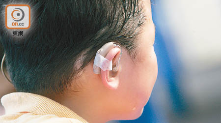 教育局為聽障幼兒及學童免費提供的「助聽器驗配及相關服務」再度流標。