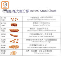 糞便形狀及軟硬度變化，也可能是早期腦退化特徵。