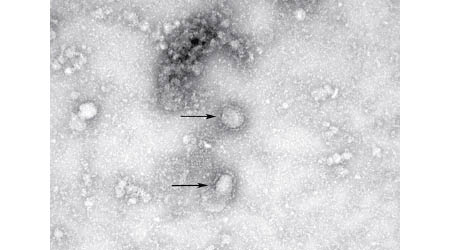武漢肺炎的新型冠狀病毒在顯微鏡下影像。（GISAID網上圖片）