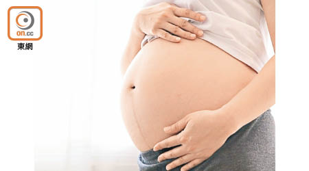 威院發現參加「溫柔分娩預備班」的婦女順產機率較高。