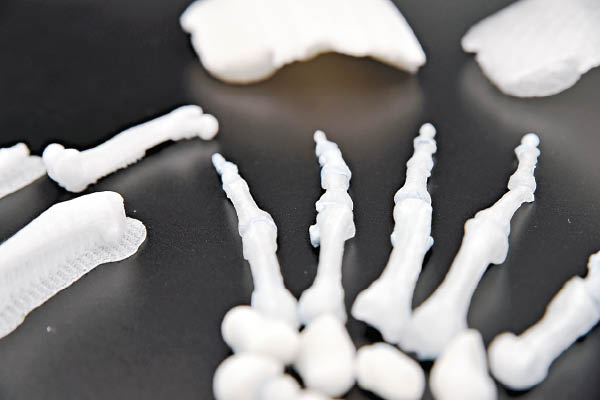 骨骼3D打印有助為骨科病者提供可負擔的醫療方案。（Ossfila提供）
