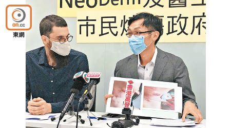 有美容監察組織指收到市民投訴關於醫生操作醫療儀器涉疏忽的個案。