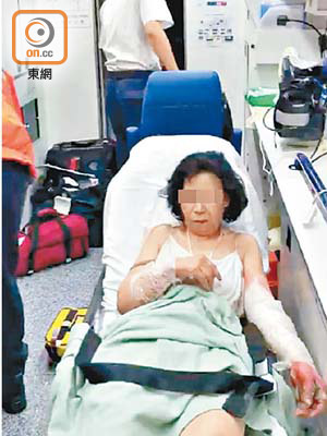 妻子手腳燒傷送院，涉嫌縱火被捕。
