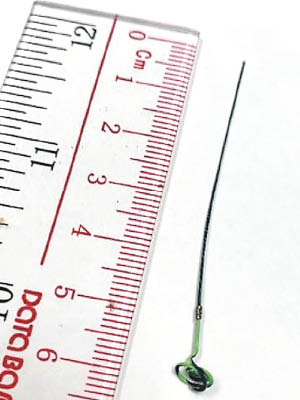 病人右輸尿管遺漏了約6厘米長的儀器碎片。