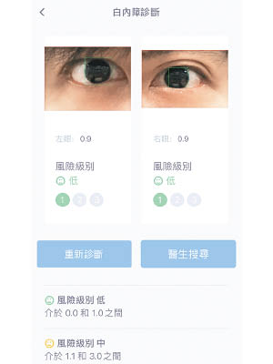 用戶拍攝瞳孔近照後上載程式，系統便能初步評估患上白內障的風險。