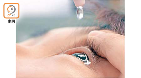 嚴重的眼敏感可能要用上類固醇眼藥水，且必須由醫生處方。