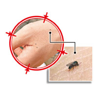 蠓蟲如芝麻般細小，被咬後痕癢難耐。